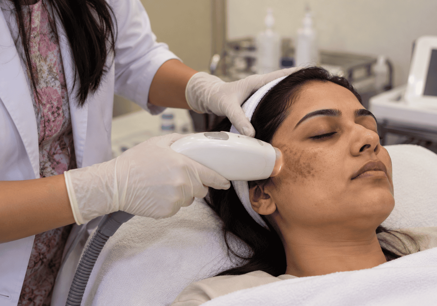 melasma treatment in jaipur