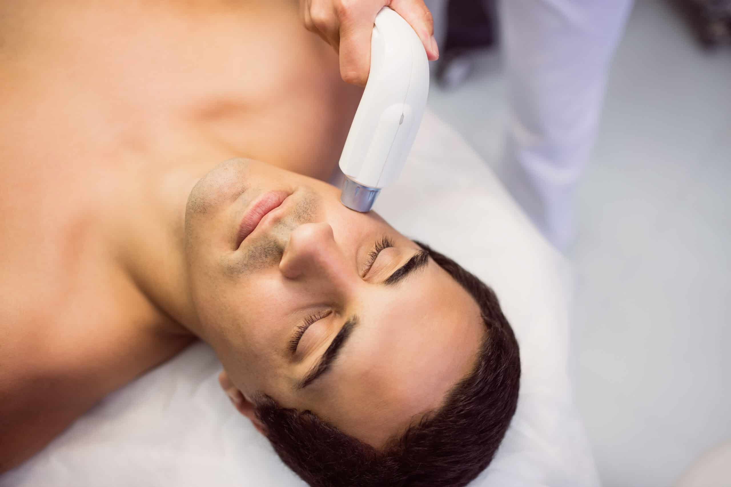 laser hair removal